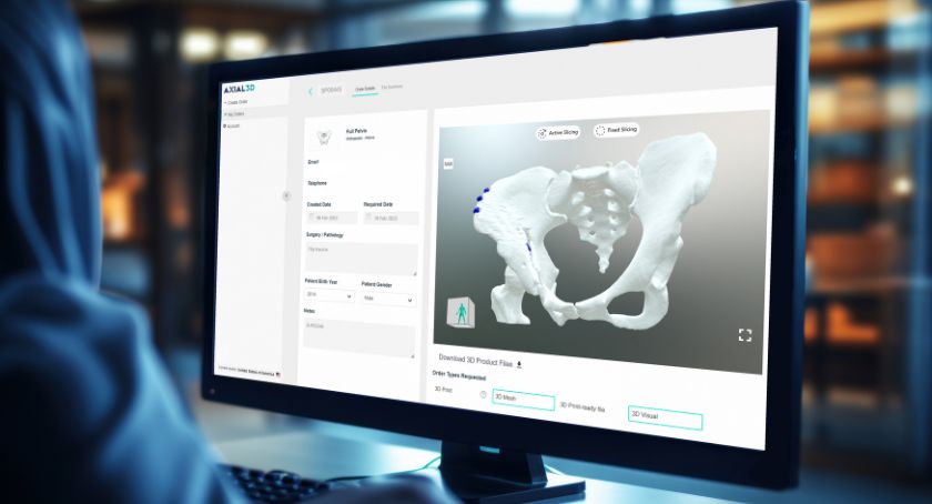 Automatically convert DICOM to 3D using an AI-assisted, cloud-based platform.