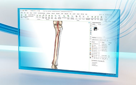 Accelerated segmentation—Accelerate the creation of 3D reconstructions of patient anatomy with cloud-based, AI-enabled automatic segmentation. Complement cloud solutions with in-depth editing capabilities using the desktop-based Mimics Core software.