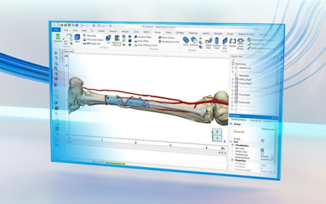 Extensive planning tools—Develop your patient-specific medical devices with our anatomy-based design software. Automate the design of personalized medical implants or guides to gain time and compress lead time.