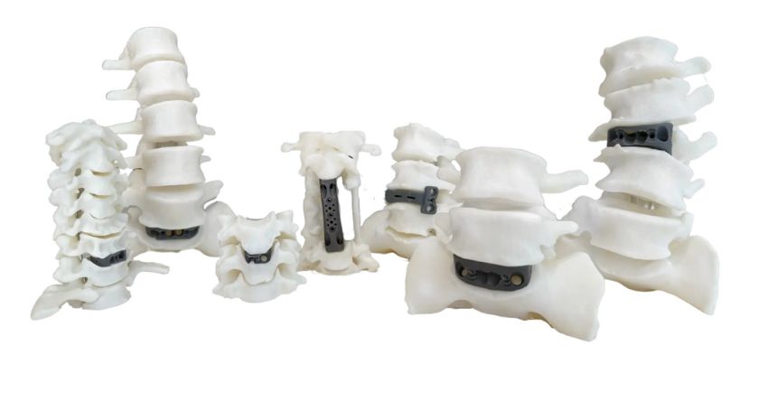 Navigating 3D Technologies: A Success Blueprint for Medical Device Start-Ups