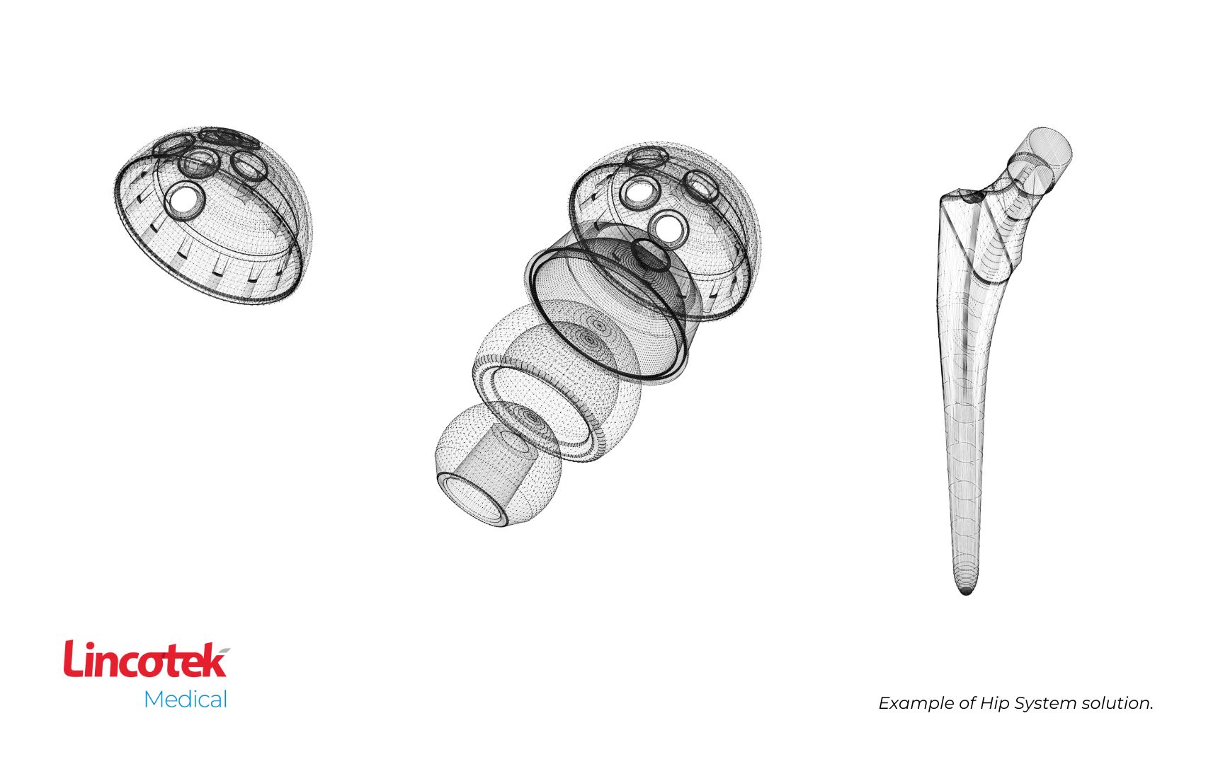 Lincotek’s ready-to-market implant solution for OEMs—Hip System