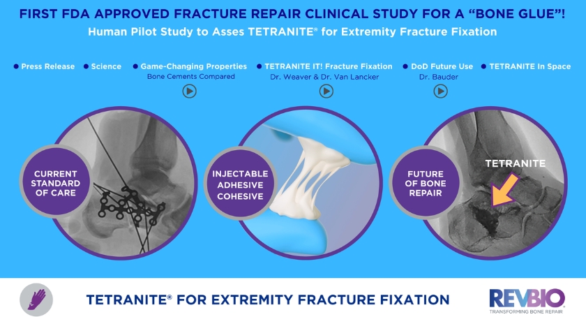 RevBio Earns FDA Approval for Trial of ‘Bone Glue’ for Extremity Fractures